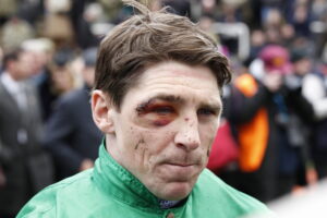 20J0031 Harry Skelton